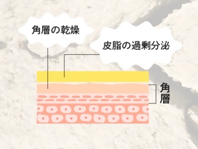 MDNA SKIN マドンナシークレットクリーム 5281個で5役のオールインワンクリーム